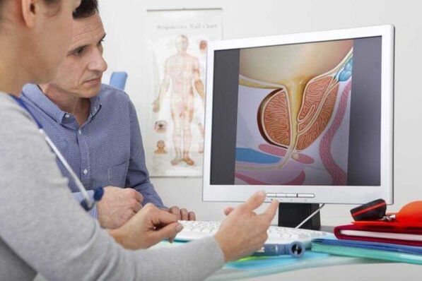 gydytojas konsultuoja pacientą prostatito klausimu