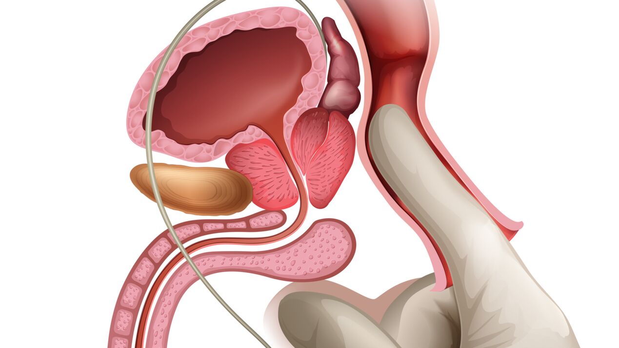 Prostatos masažas yra veiksmingas stazinio prostatito gydymo būdas