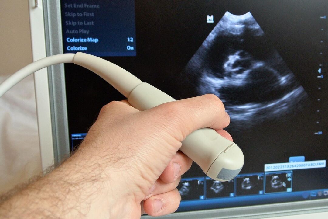 Ultragarsas padės diagnozuoti stazinį prostatitą vyrams